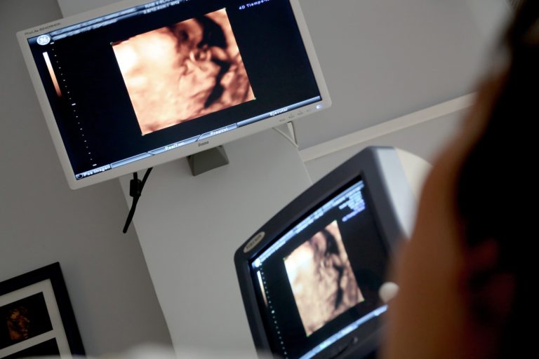 EKFH seeking donations for Invermere Hospital ultrasound